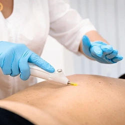 Cанаторий «Вернисаж» г. Кисловодск. Карбокситерапия Cанаторий «Вернисаж» г. Кисловодск. Карбокситерапия